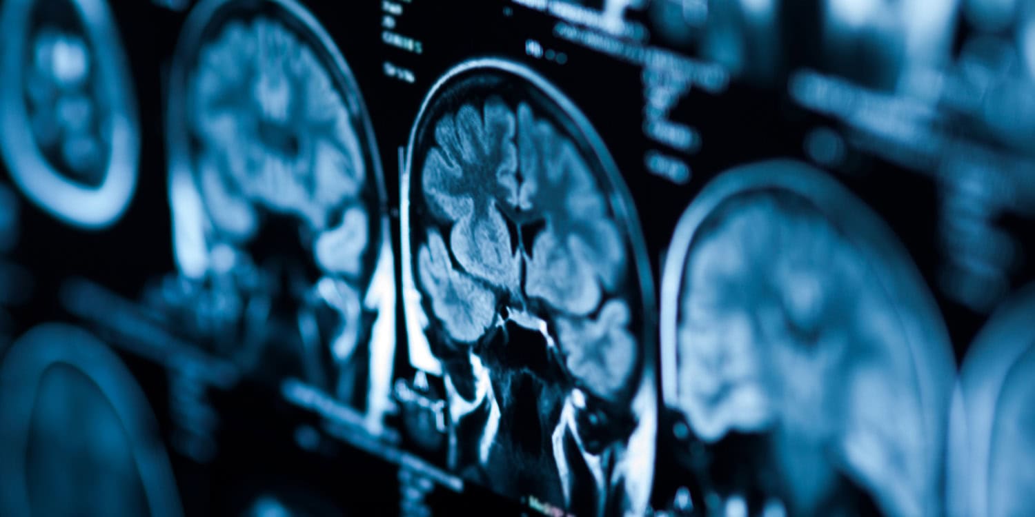 Brain scans shed light on how green space might support children’s cognitive development
