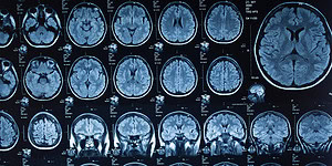 Brain scan MRI images showing detailed views of brain structures for neurological and psychological research.
