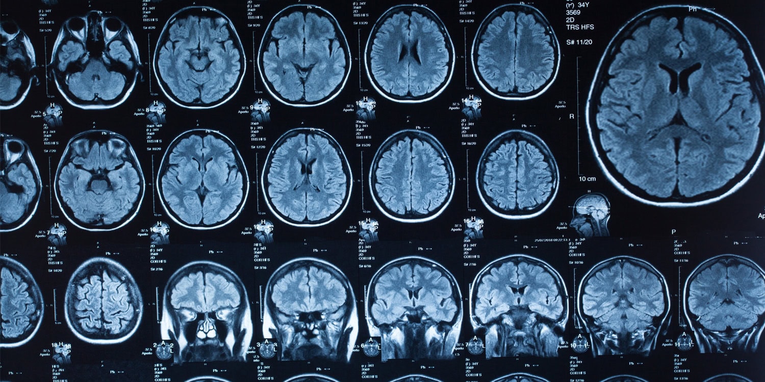 People on the far-right and far-left exhibit strikingly similar brain responses