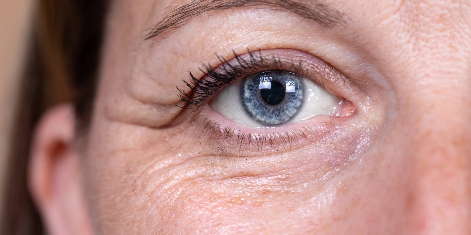 Wrinkles around the eyes are the primary driver of age perception across five ethnic groups