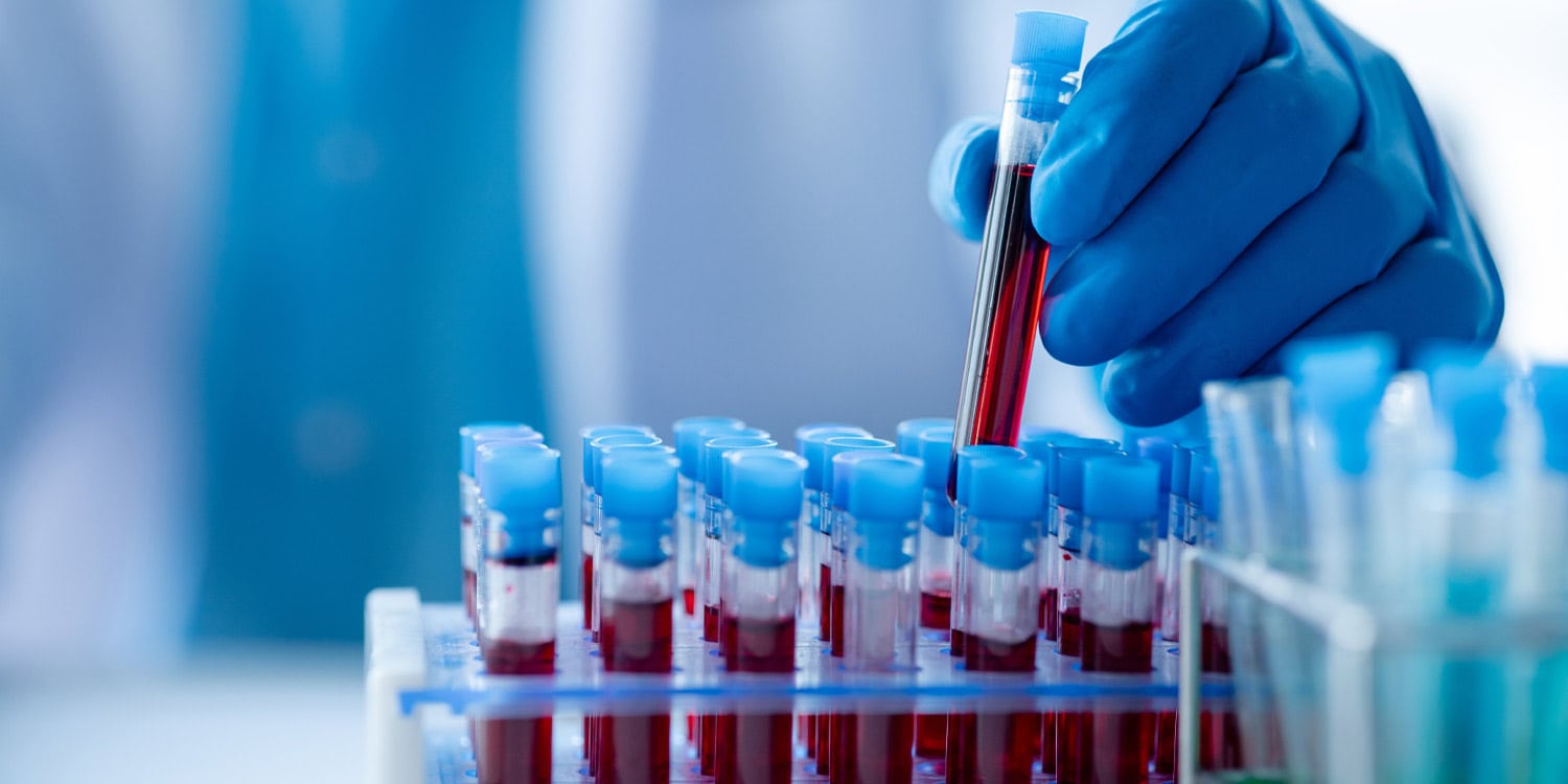 Blood test might detect Parkinson’s disease years before physical symptoms appear